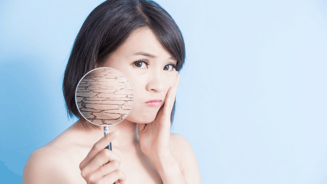 Trockene Haut im Gesicht – Symptome, Ursachen – Wie pflegst Du Sie richtige! - BeautySeele