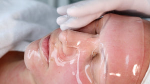 Beauty Ratenzahlung für Micro - Needling - Finanzierungsoptionen - BeautySeele
