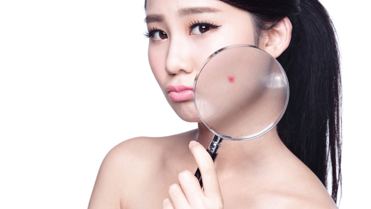 Face-Mapping – was Pickel über Deine Gesundheit im Gesicht verraten