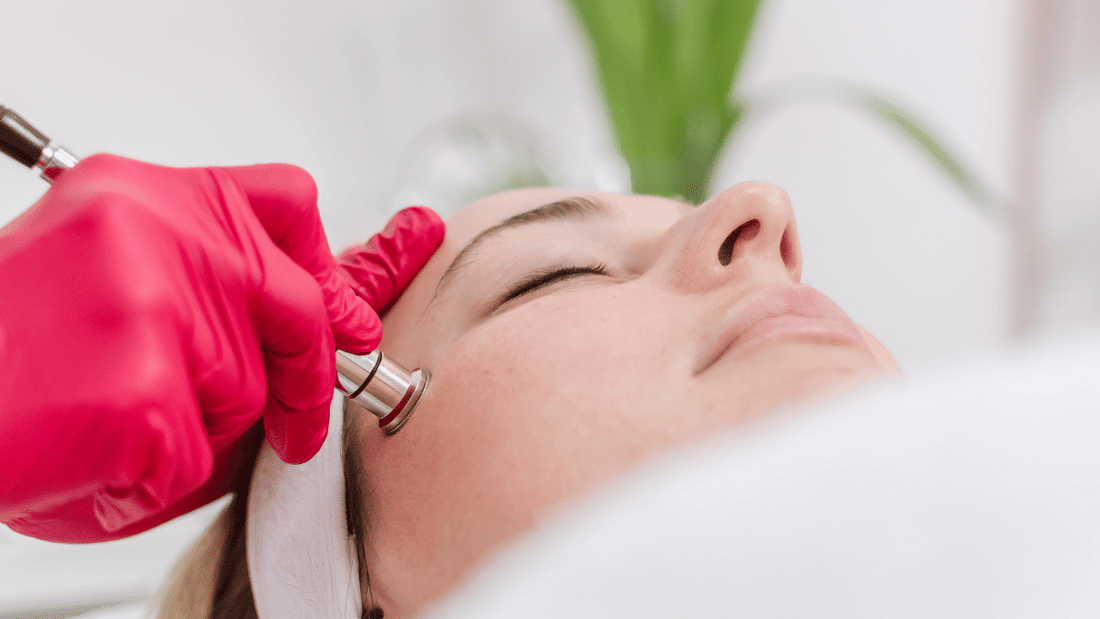 Microdermabrasion zu Hause – das passende Gerät finden