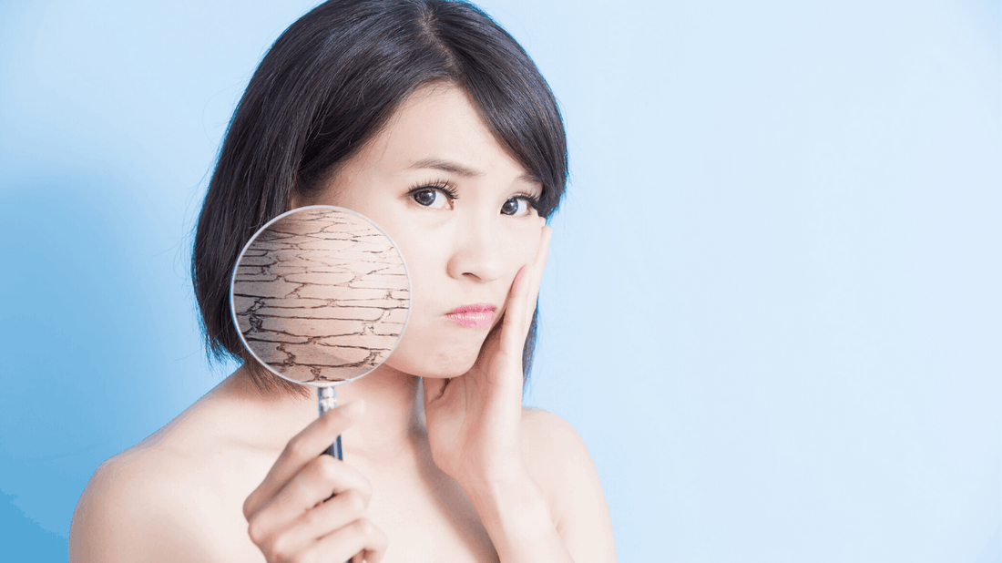 Trockene Haut im Gesicht – Symptome, Ursachen – Wie pflegst Du Sie richtige!