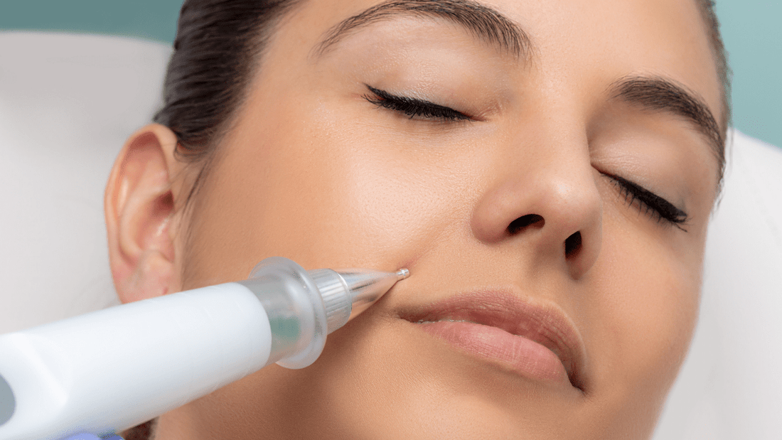 Warum ist Cold Plasma so gut für Ihre Haut?