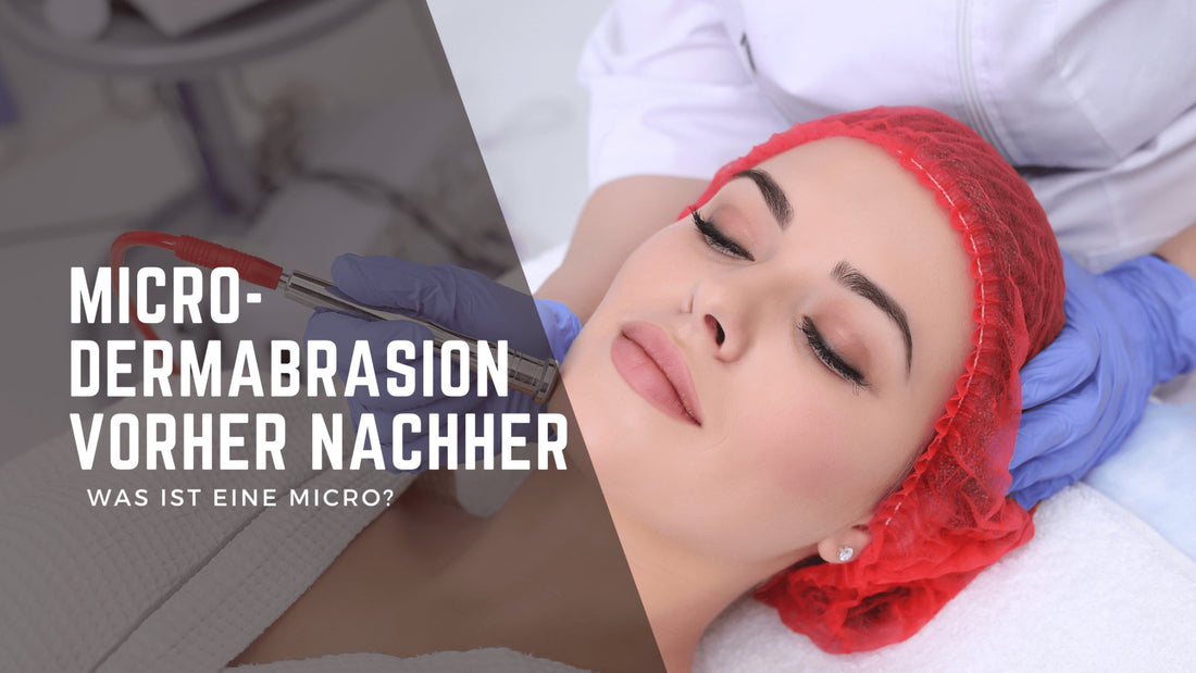 Microdermabrasion vorher nachher – Was ist eine Micro? - BeautySeele