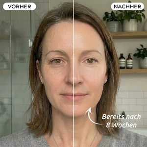 LED Lichttherapie Maske