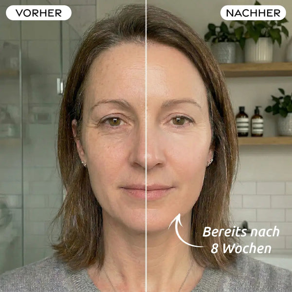 LED Lichttherapie Maske