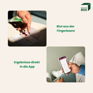 STI Test Select - Geschlechtskrankheiten-Test