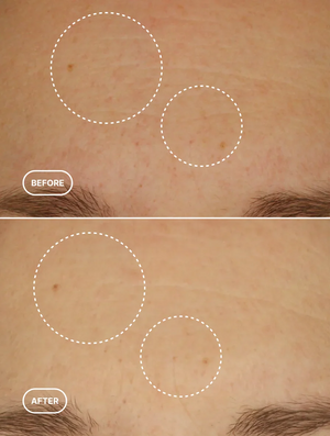 Retinol Alternative Moisturiser